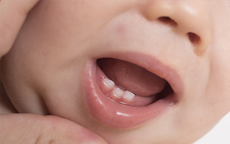 infant oral care in nyc
