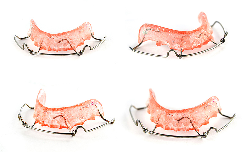 removable retainer price in NYC