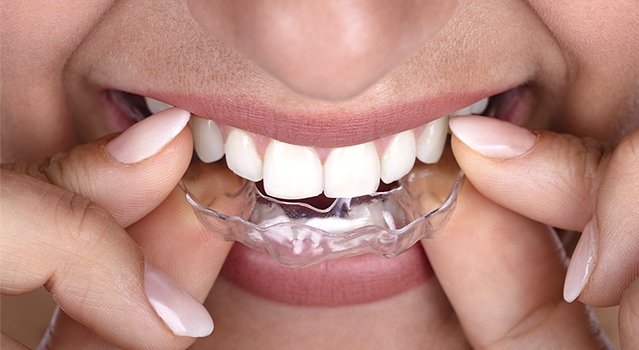 invisalign new york