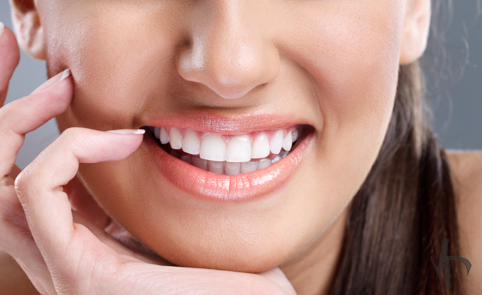 5 Teeth Whitening Aftercare Tips