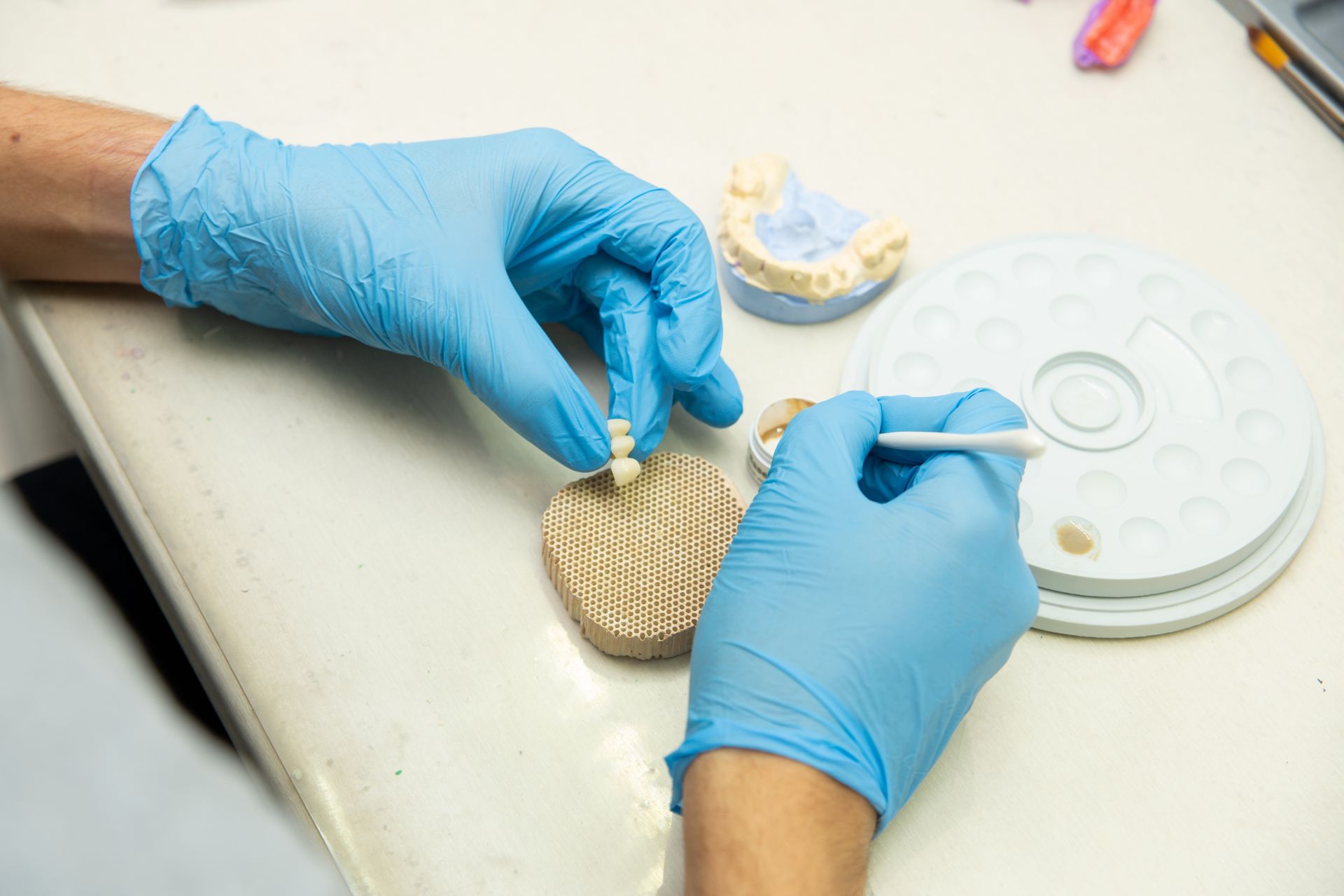 Antibacterial Dental Composites and Their Benefits