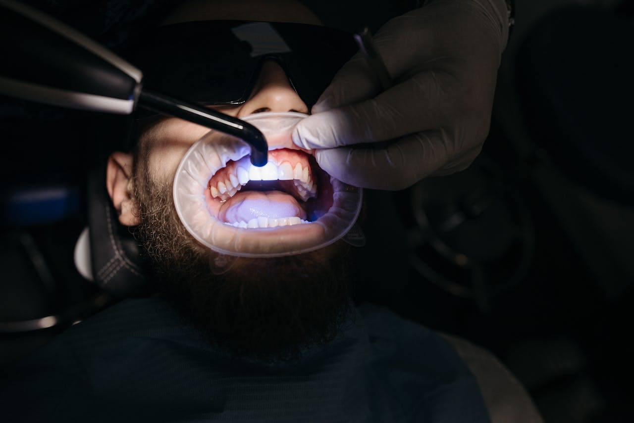 Fluorescence Technology for Early Caries Detection