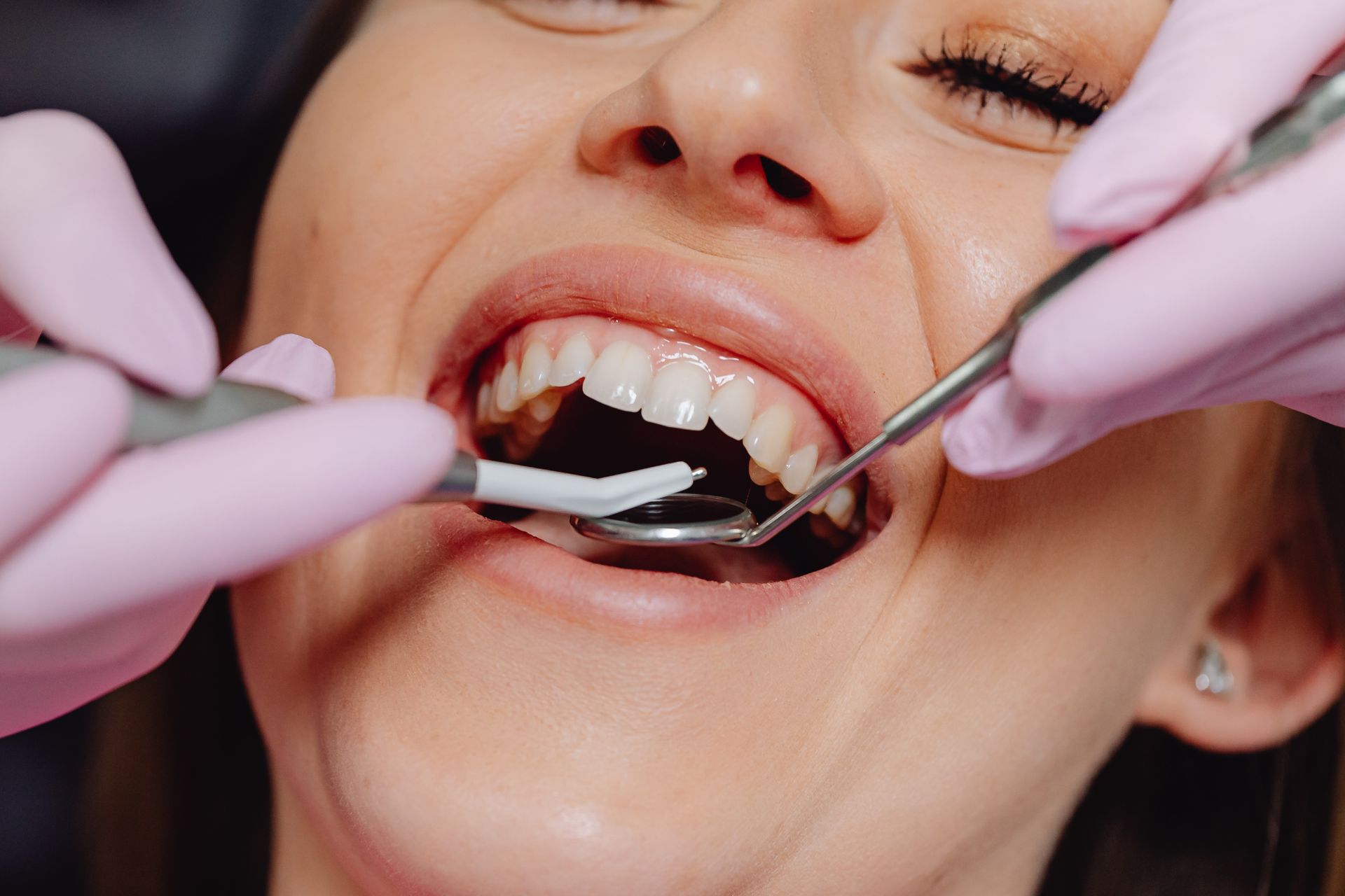 gum tissue regeneration