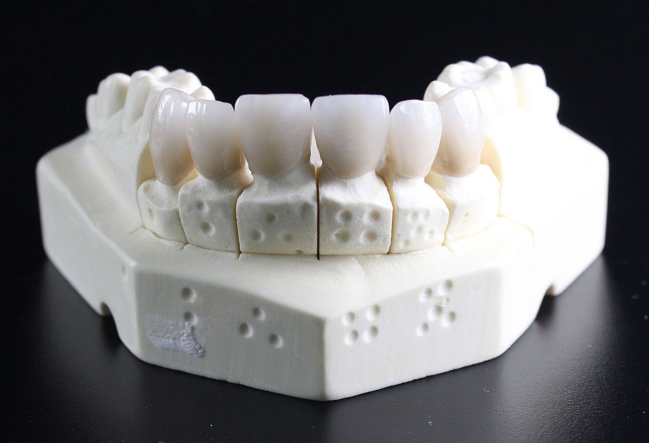 Acrylic Dentures: Pros and Cons
