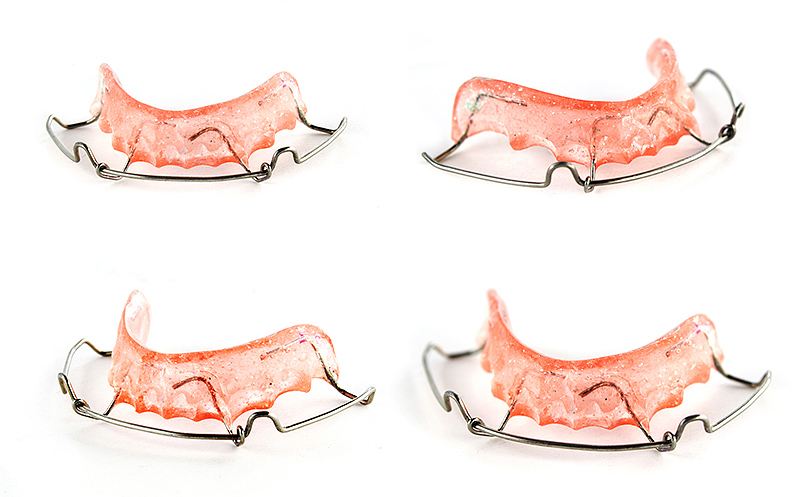 Removable Retainer removable retainer price in NYC