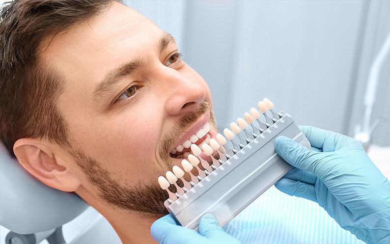 Veneers veneers in nyc