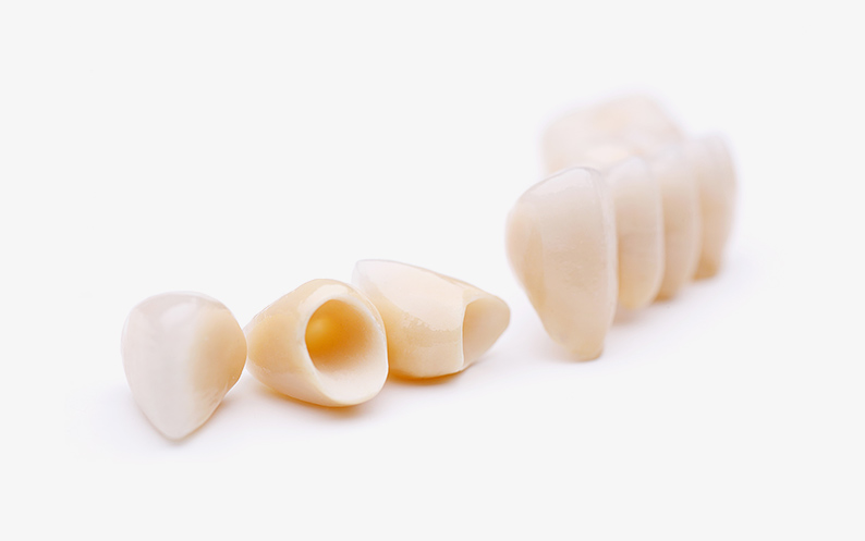 Porcelain Crowns porcelain crowns nyc