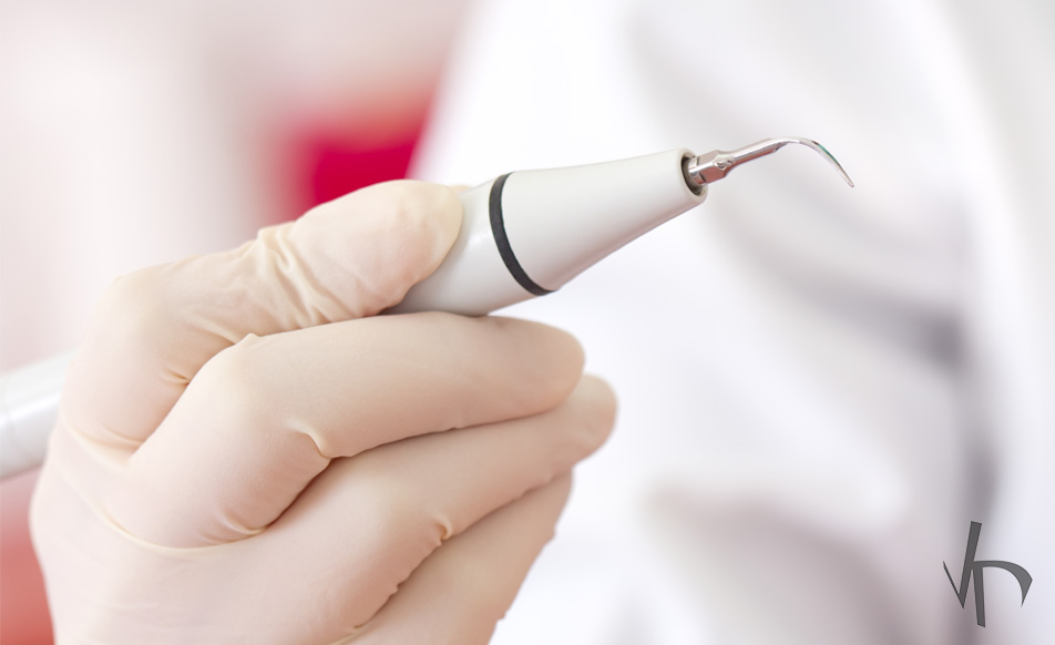 Methods for Tartar Removal