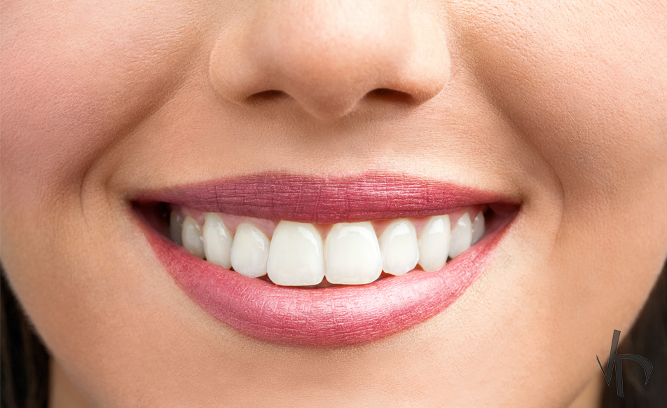 The Main Ways to Remineralize Teeth