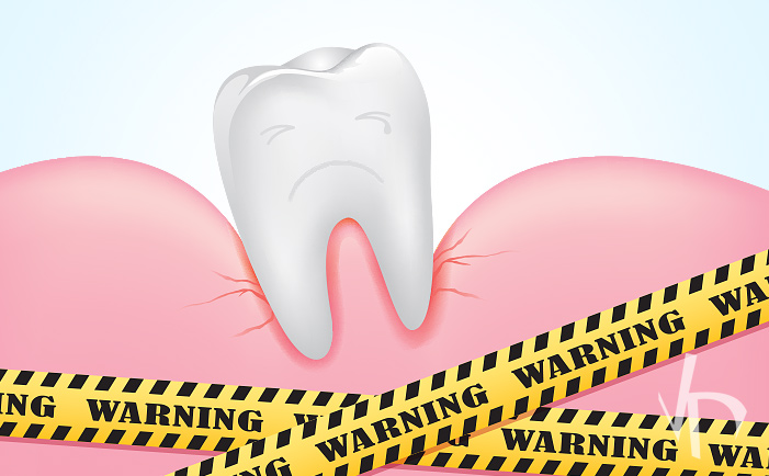 The Oldest Widespread Disease in the World: Tooth Decay
